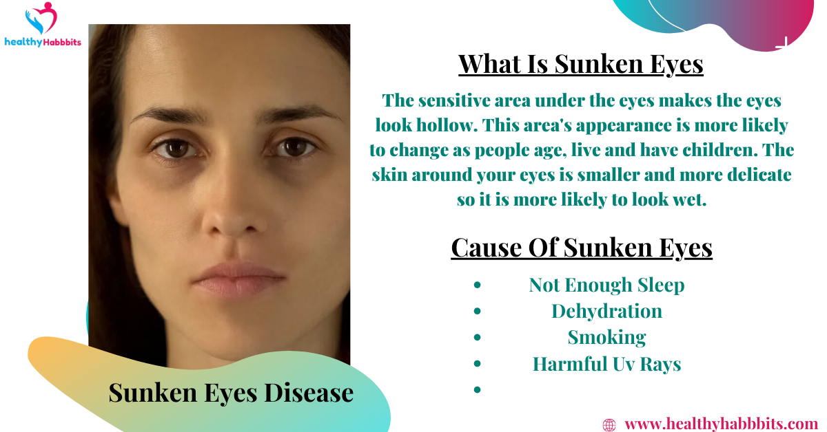 Sunken Eyes Causes Symptoms And Signs And Best Treatments 2024